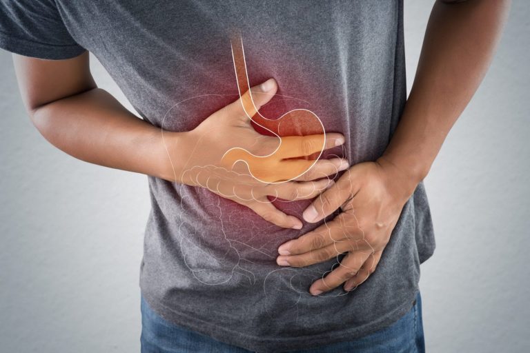 5 herbs instead of antacids