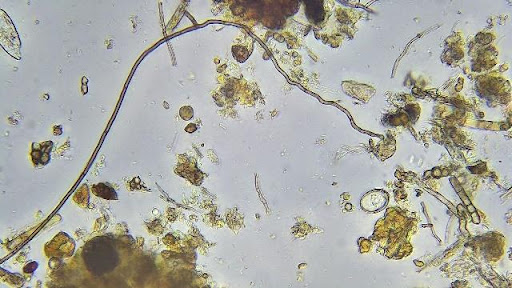 A saprotrophic fungal hyphae