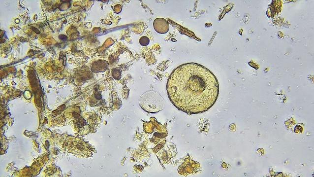 An arcella amoeba