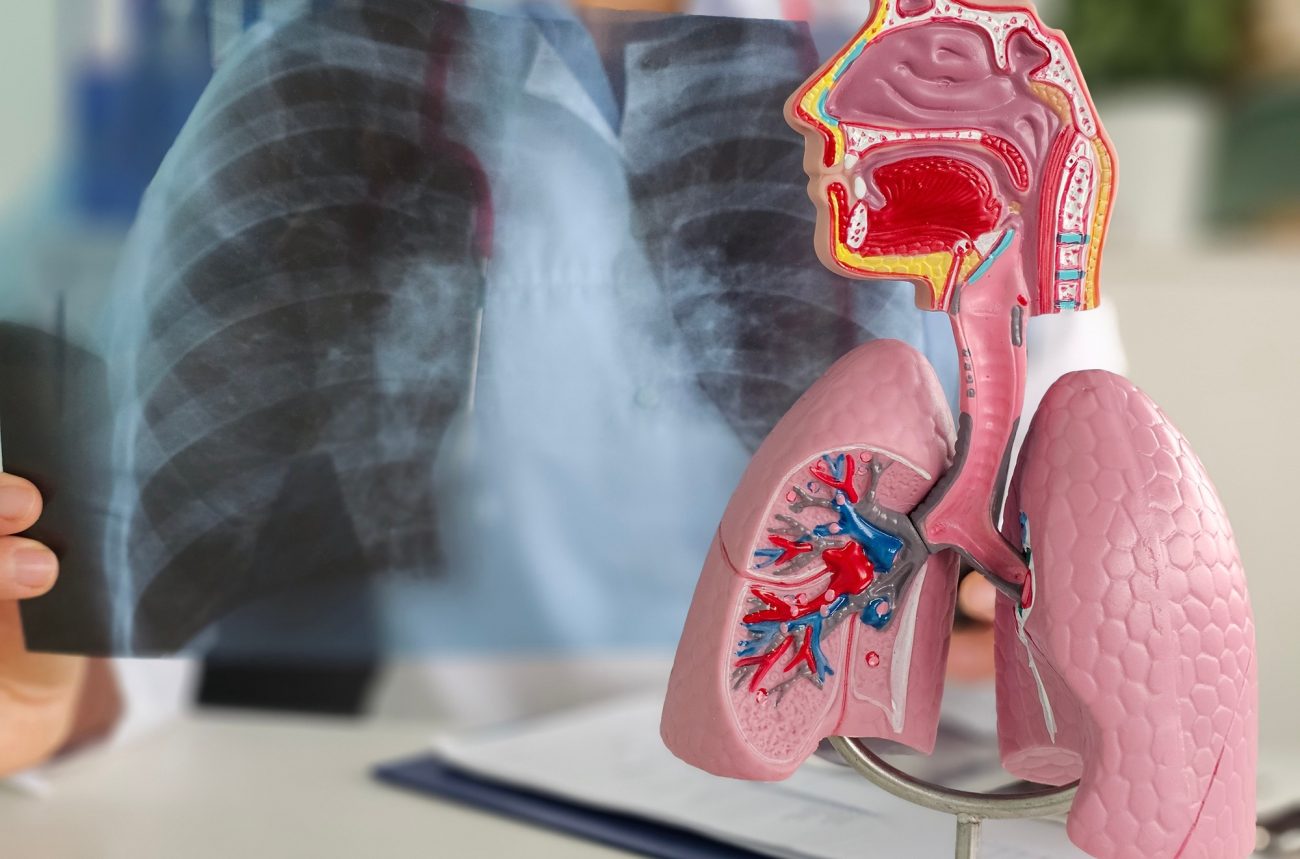Causes Of Chronic Obstructive Pulmonary Disease COPD