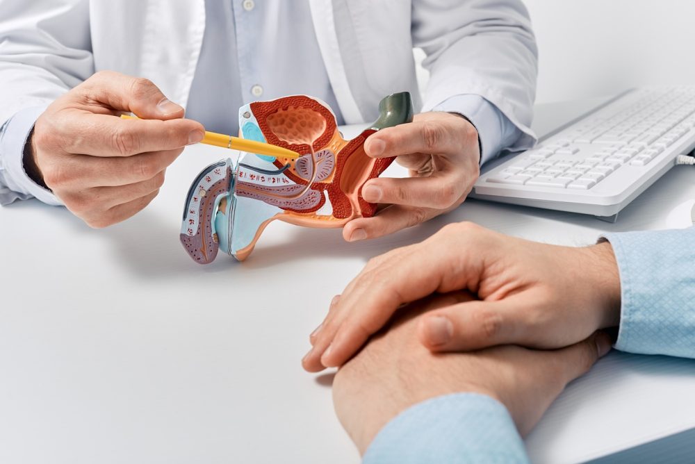 Prostate Enlargement Benign Prostatic Hyperplasia