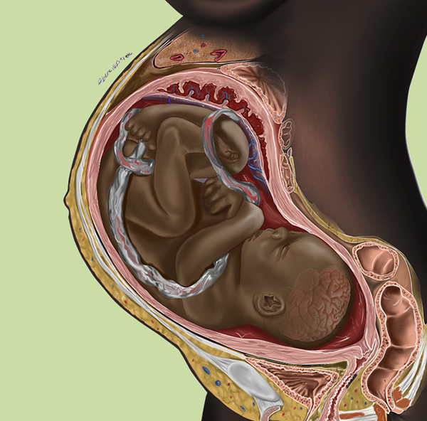 Deconstructing Racial Bias In Clinical Practice