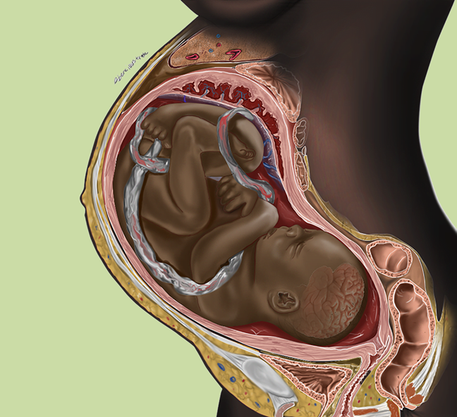 Deconstructing racial bias in clinical practice