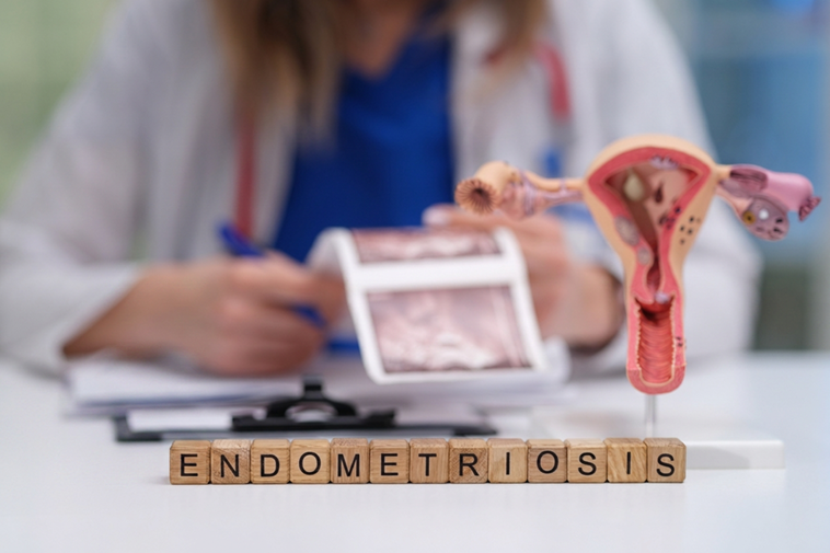 Endometriosis Update Emerging Science And The Role Of Herbal Medicine